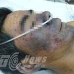 Đắng lòng ăn bát tiết canh